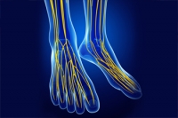 What Is Tarsal Tunnel Syndrome?