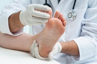 Athlete’s Foot Is a Common Foot Infection